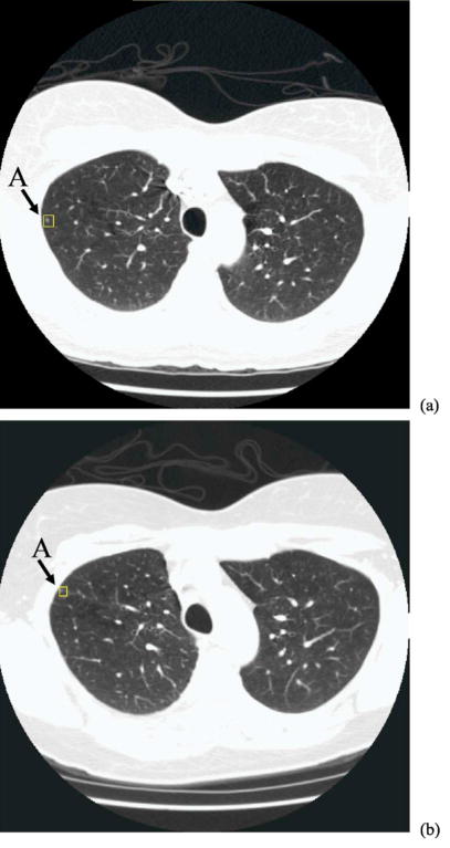 Fig. 11