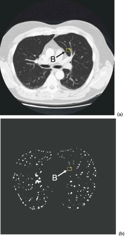 Fig. 12