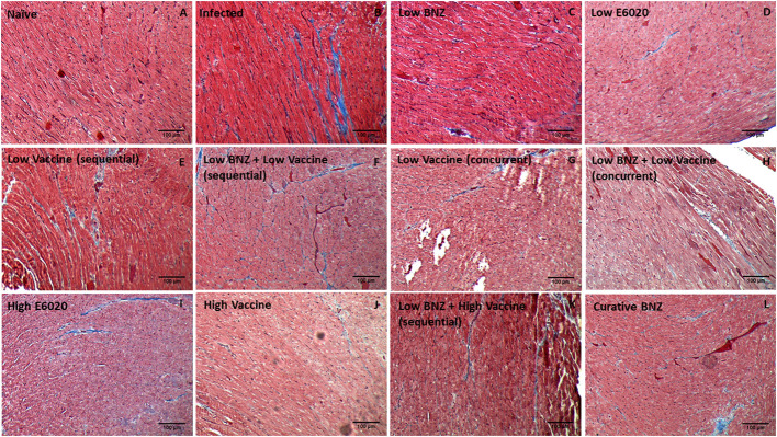 Figure 11