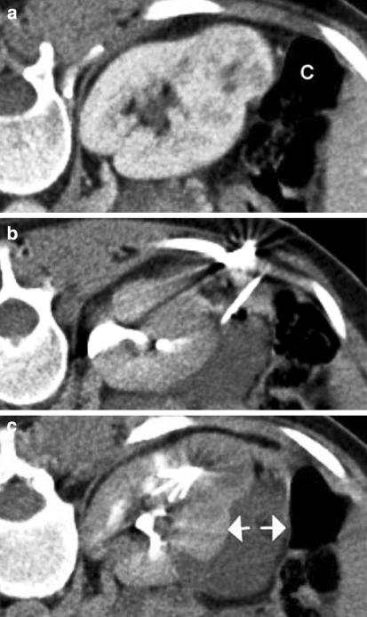 Fig. 1