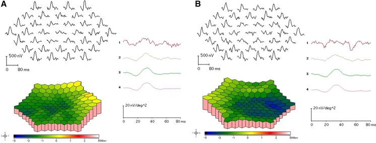 Fig. 3