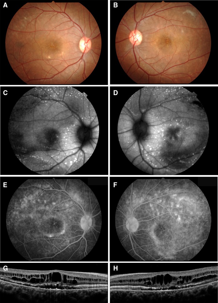 Fig. 1