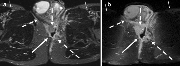 Fig. 13