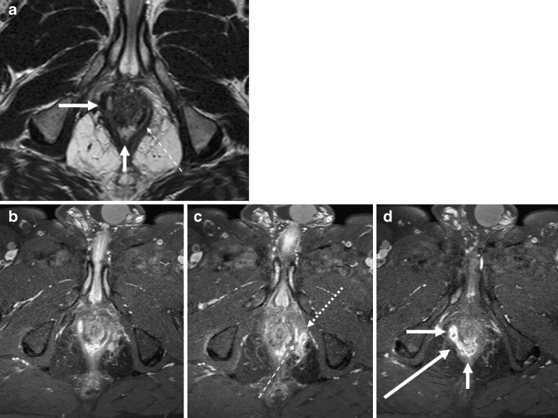 Fig. 4