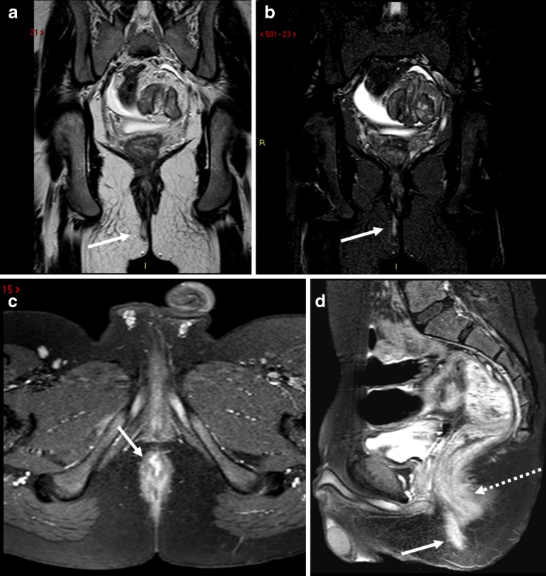 Fig. 14