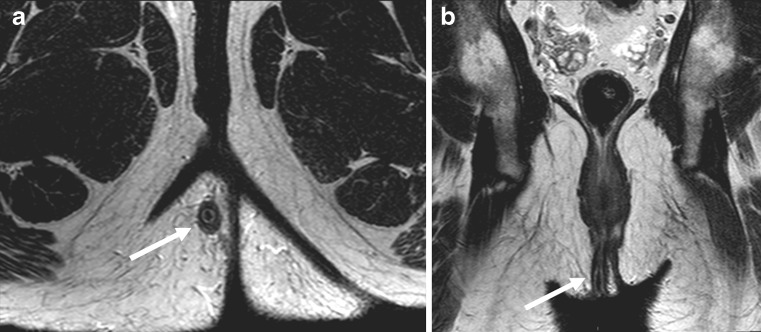 Fig. 9