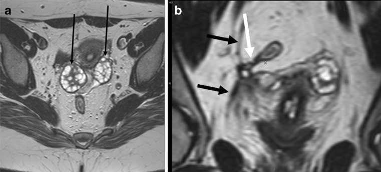 Fig. 15