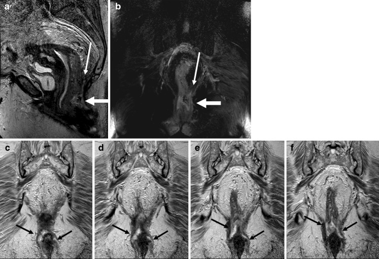 Fig. 6