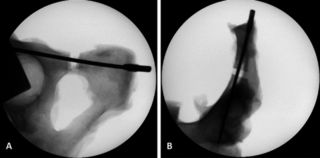 Fig. 4