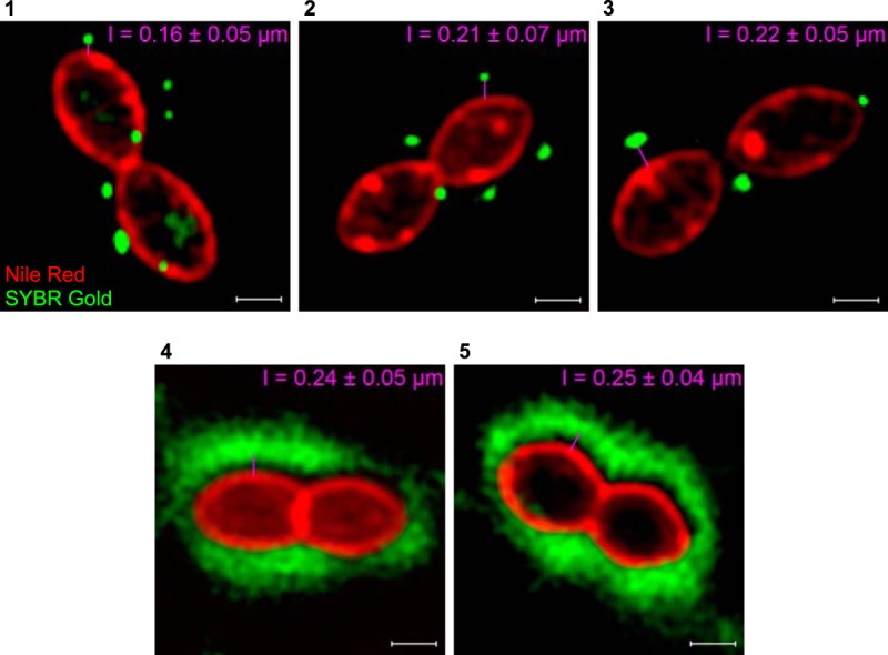 FIG 3