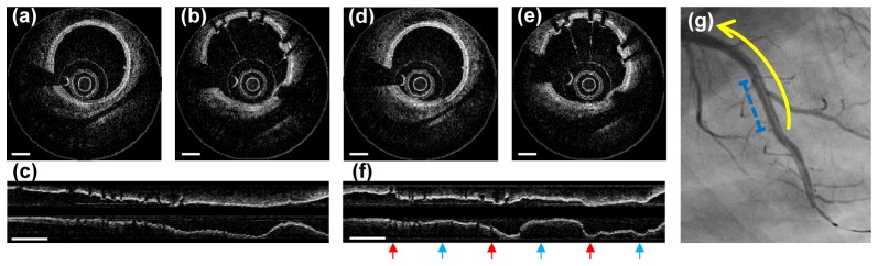 Fig. 4