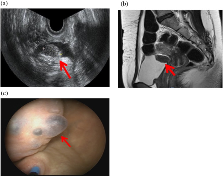 Fig. 1