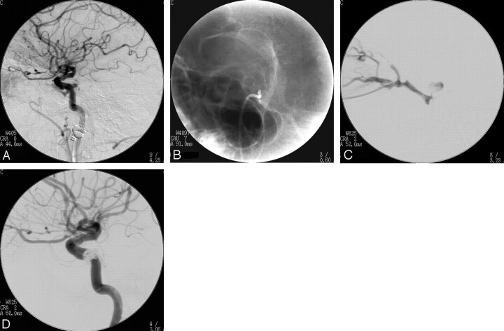 Fig 2.