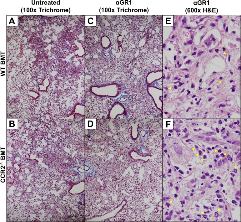 Fig. 14.