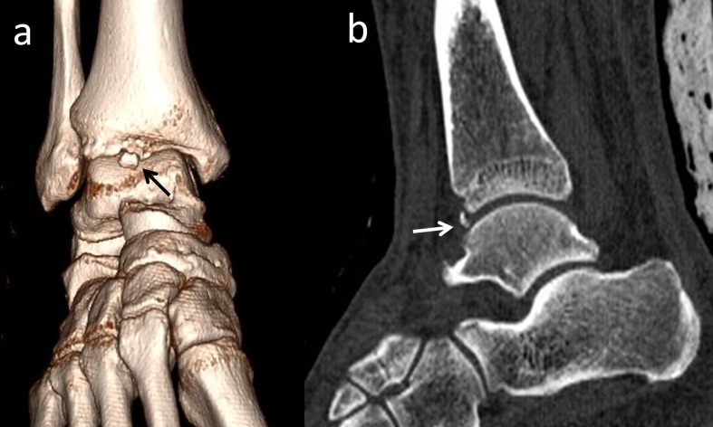 Figure 14