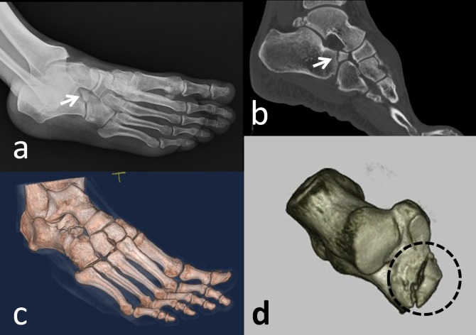 Figure 12