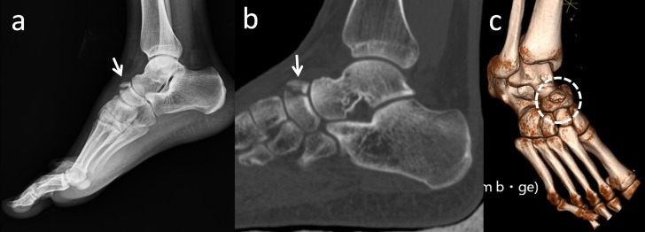Figure 16