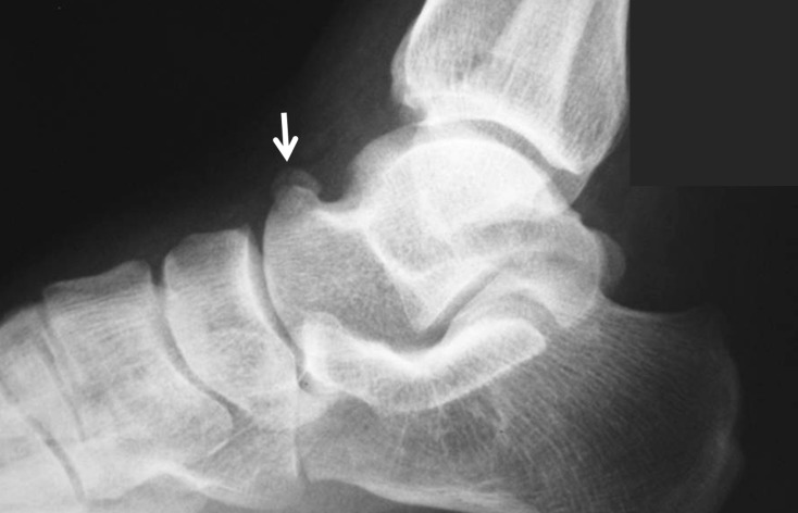 Figure 13