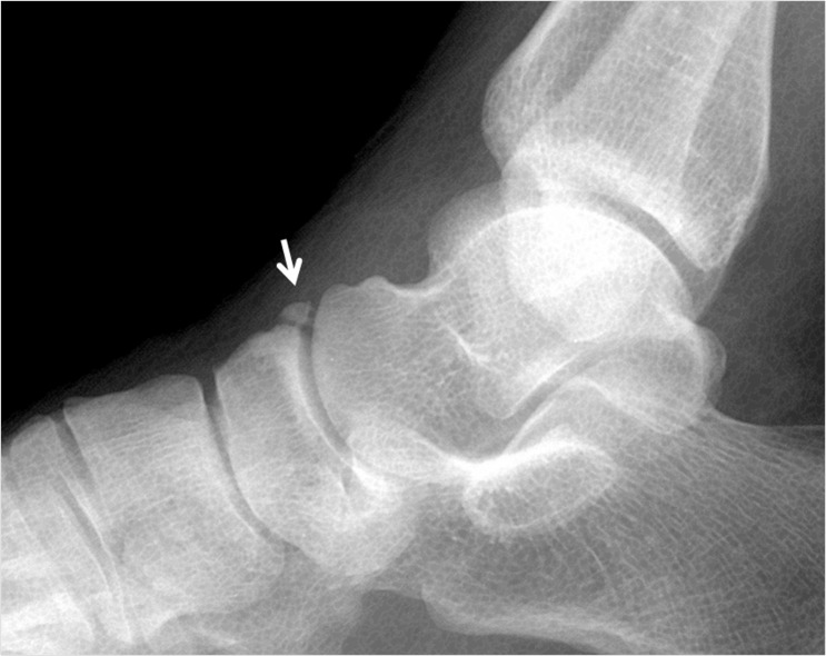 Figure 15