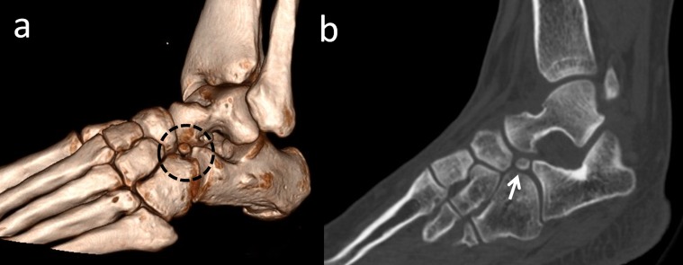 Figure 11