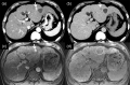 Fig. 11
