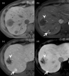Fig. 12