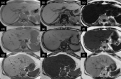Fig. 13