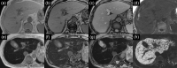 Fig. 14