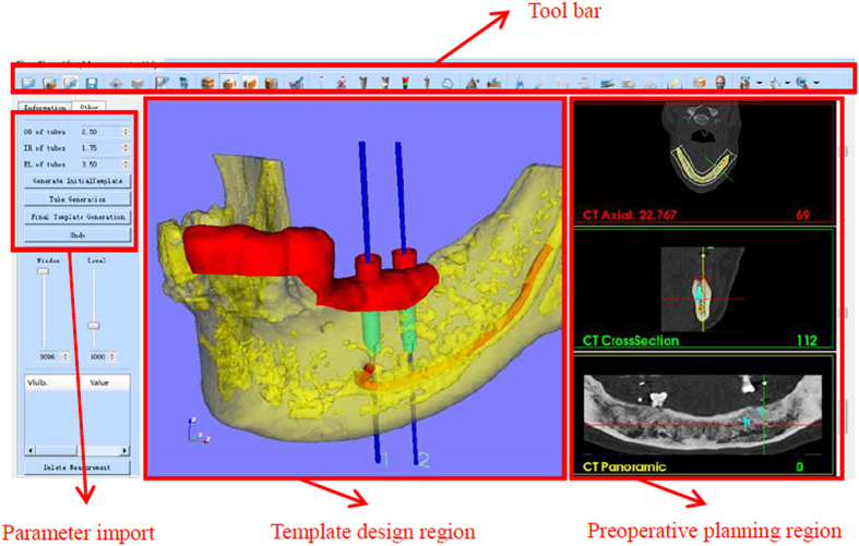 Figure 2