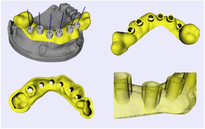 Figure 16