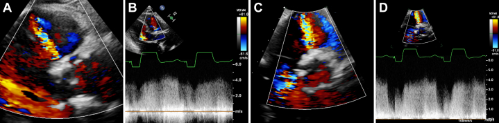 Figure 3