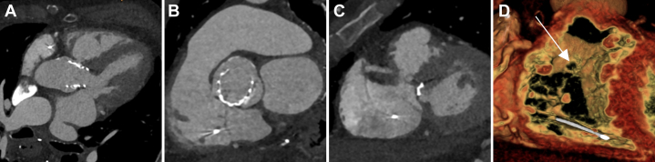 Figure 4