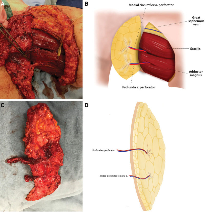 Fig. 3.