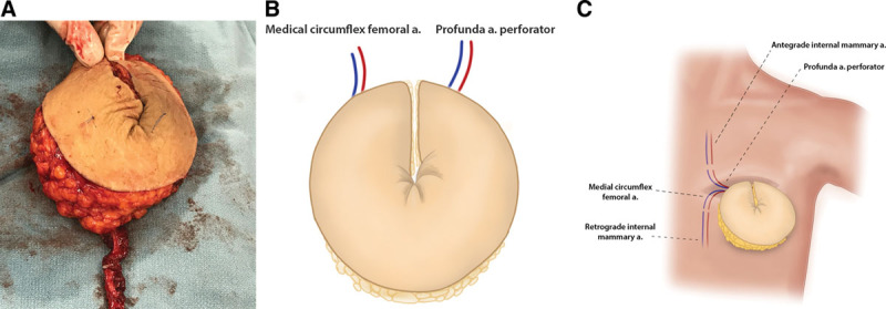 Fig. 4.