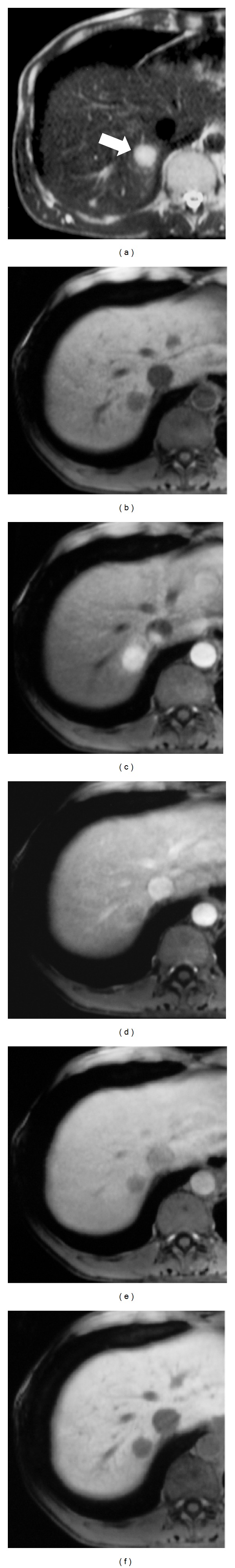 Figure 13