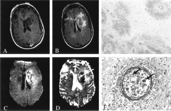 Fig 1.