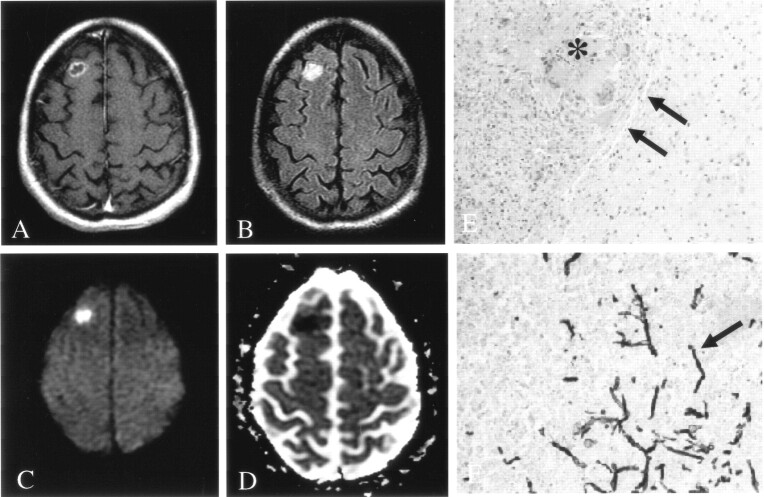 Fig 3.