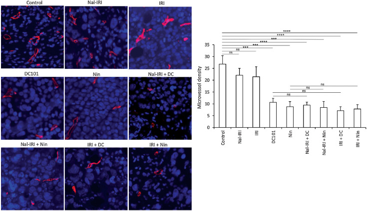 Figure 4. Effect of nal-IRI and its combination with antiangiogenic agents on microvessel density. Tumor sections obtained from the MKN-45 subcutaneous xenograft study after 2-week treatment were used for evaluating intratumoral microvessel density. Tumor sections were stained with anti-endomucin antibody and slides were photographed under a fluorescent microscope. Endomucin-positive vessels were counted within five different HPF in a blinded manner. The left panels demonstrate merged images of endomucin-positive microvessel (red) and cell nuclei (DAPI, blue) illustrated at 20× magnification. ***, P < 0.001; ****, P < 0.0001 by t test. The data are expressed as the mean ± SD.