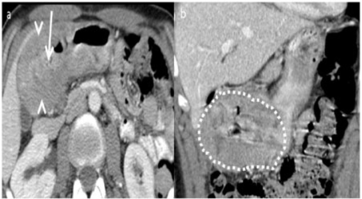 Figure 21