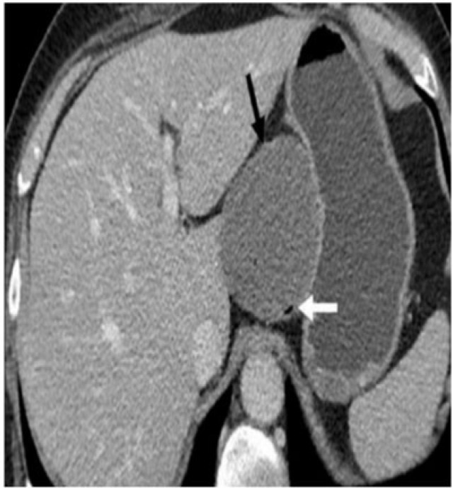 Figure 23