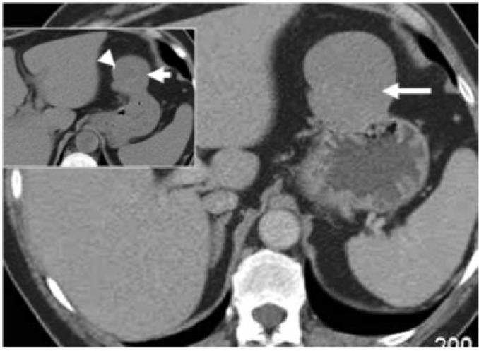 Figure 15