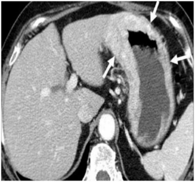 Figure 13