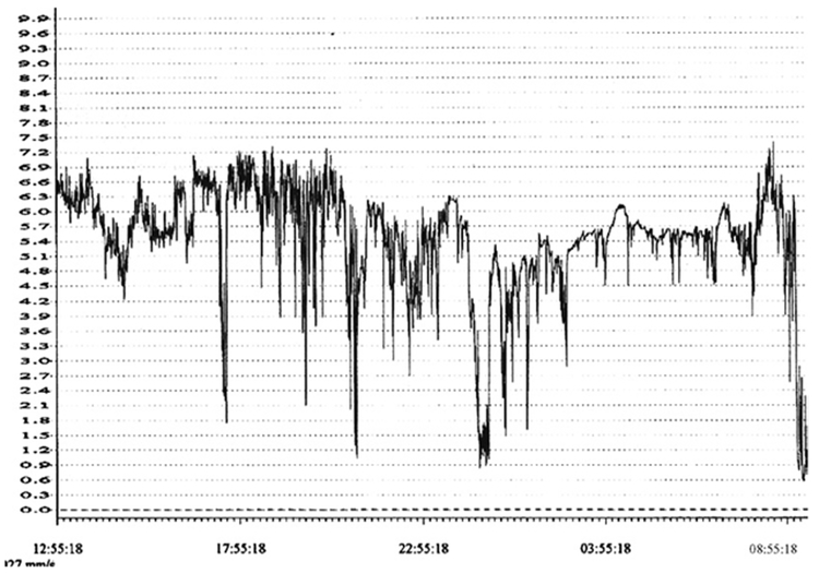 Fig 2.
