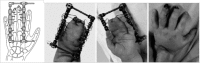 Fig. 16