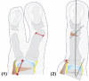 Fig. 28