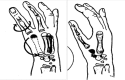 Fig. 20
