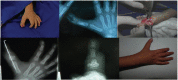 Fig. 32
