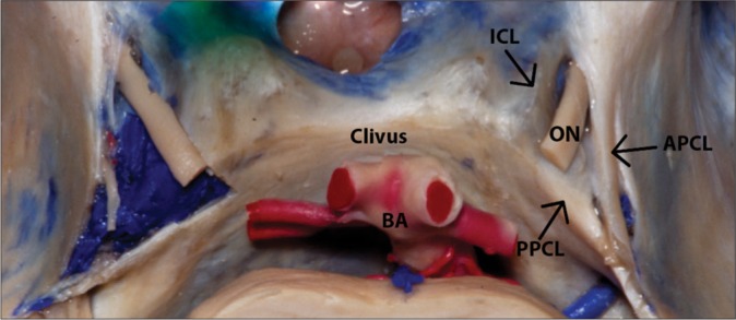 Figure 3: