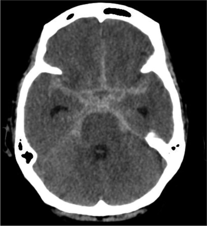 Figure 2: