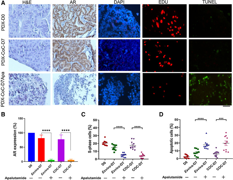 Figure 3. Response to apalutamide treatment in CoC platform. A, PC82 tumor tissue slices cultured with apalutamide for 7 days and evaluated for AR expression, cell proliferation (EdU incorporation, red nuclei), and apoptosis (TUNEL staining, green nuclei). AR staining for PC82 tissue slice sections at day 0, day 7 ex vivo culture condition, and CoC platform with and without apalutamide treatment. DAPI stains all nuclei blue. H&E, hematoxylin and eosin. Scale bar, 50 μm. B, Quantification of the AR expression in prostate PDX slices cultured in ex vivo and CoC platform. C and D, Apalutamide treatment showed a significant increase in TUNEL-positive cells and significant decrease in EdU-positive cells when compared with untreated tumor slices in our CoC platform. Ten fields of view were quantified per prostate PDX slice. Each point in the graph represents one image field and SEM is indicated for 10 fields. D7, day 7; D0, day 0. ***, P < 0.001; ****, P < 0.0001.